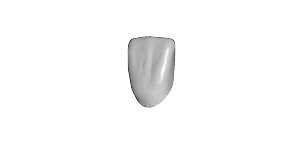 Veneers